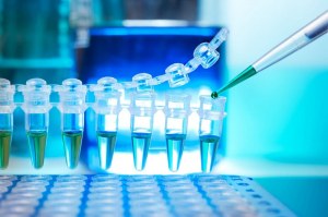 qPCR pour le diagnostic