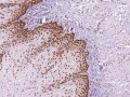 Nouveaux anticorps pour le diagnostic = échantillons gratuits