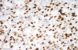 Anti-Myogénine CE/IVD pour IHC - Pathologie des tissus mous