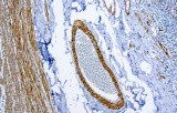 Anti-Myosine du muscle lisse CE/IVD pour IHC - pathologies gynécologiques