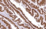 Anti-p53 CE/IVD pour IHC - pathologies uro-génitales