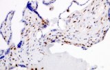 Anti-p57kip2 CE/IVD pour IHC - pathologies uro-génitales