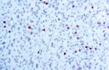 Phosphohistone 3 (PHH3)