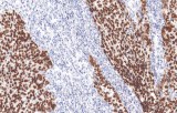 Anti-SALL4 CE/IVD pour IHC - pathologies uro-génitales