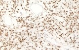 Anti-STAT6 du muscle lisse CE/IVD pour IHC - Pathologie des tissus mous