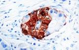 Anti-Synaptophysine CE/IVD pour IHC - Neuropathologie